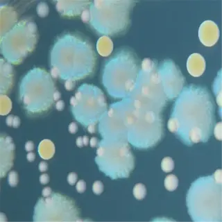 a petri dish with a soil bacteria culture showing various colonies