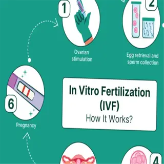 infographic illustrating the in vitro fertilization (ivf) process, a medical fertilizing protocol